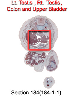 Testes, Colon and Upper Bladder