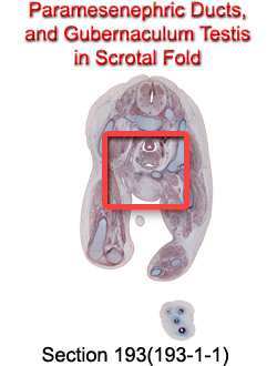 Paramesenephric Ducts, and Gubernaculum Testis in Scrotal Fold