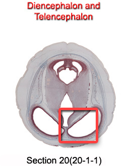 Diencephalon and Telencephalon