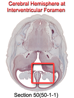 Cerebral Hemisphere at Interventricular Foramen