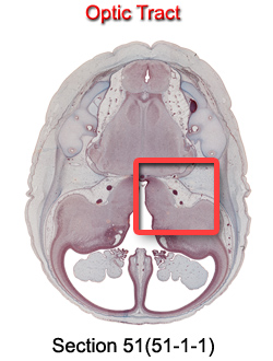 Optic Tract