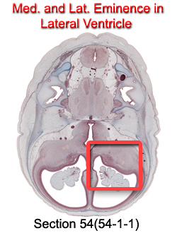 Med. and Lat. Eminence in Lateral Ventricle