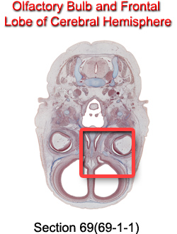 Olfactory Bulb and Frontal Lobe of Cerebral Hemisphere