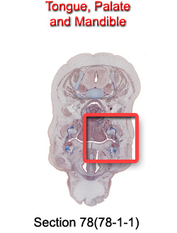 Tongue, Palate, and Mandible