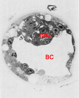 A section through the inner cell mass (embryoblast) of an unexpanded embryo