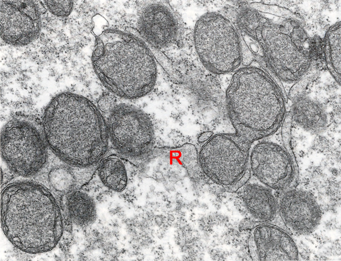 Early embryo showing details of mitochondria