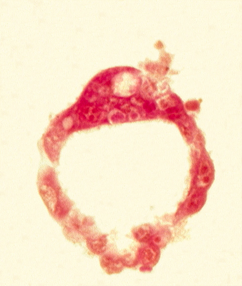 abembryonic pole, blastocystic cavity (blastocoele), embryonic pole, epiblast, hypoblast, inner cell mass (embryoblast), mural trophoblast, polar trophoblast