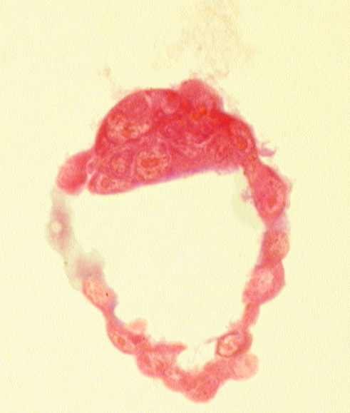 abembryonic pole, blastocystic cavity (blastocoele), embryonic pole, epiblast, hypoblast, inner cell mass (embryoblast), mural trophoblast, polar trophoblast