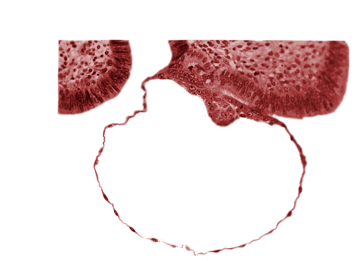 blastocystic cavity (blastocoele), contact area(s), embryonic disc, gap in contact area, mural trophoblast, syncytiotrophoblast nuclei