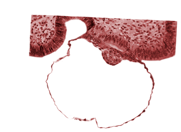 blastocystic cavity (blastocoele), cytotrophoblast, edematous endometrial stroma (decidua), endometrial (uterine) epithelium, epiblast, gap in contact area, hypoblast, mural trophoblast, primordium of amniotic cavity, syncytiotrophoblast