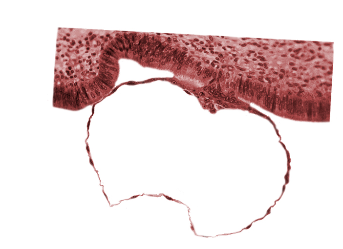 blastocystic cavity (blastocoele), contact area(s), embryonic disc, mural trophoblast