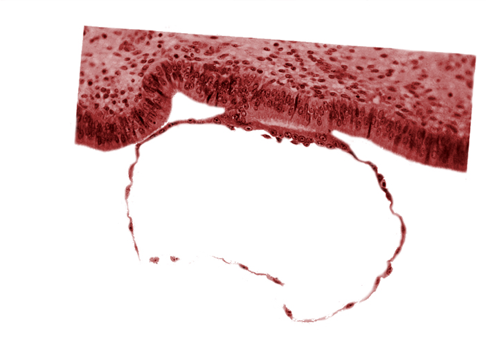 blastocystic cavity (blastocoele), edge of contact area, endometrial (uterine) epithelium, endometrial (uterine) stroma, syncytiotrophoblast