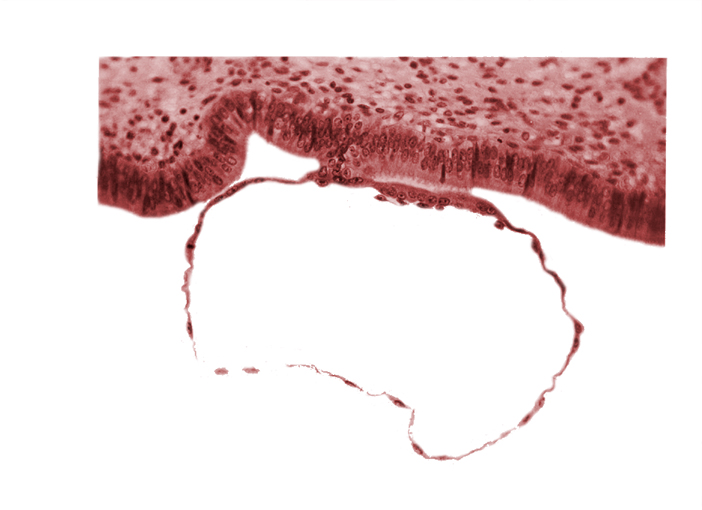 contact area(s), cytotrophoblast, mural trophoblast, syncytiotrophoblast