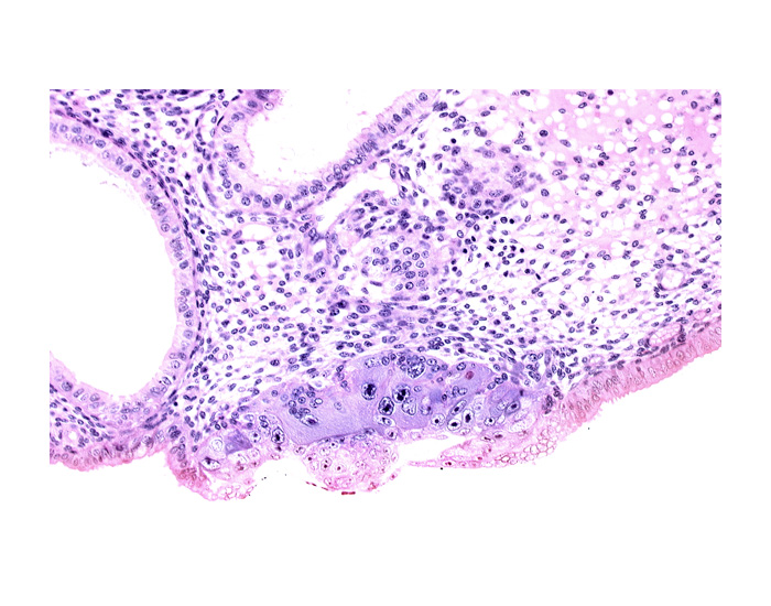 blastocystic cavity (blastocoele), embryonic disc, endometrial sinusoid, membranous trophoblast at abembryonic pole, syncytiotrophoblast / decidua interface