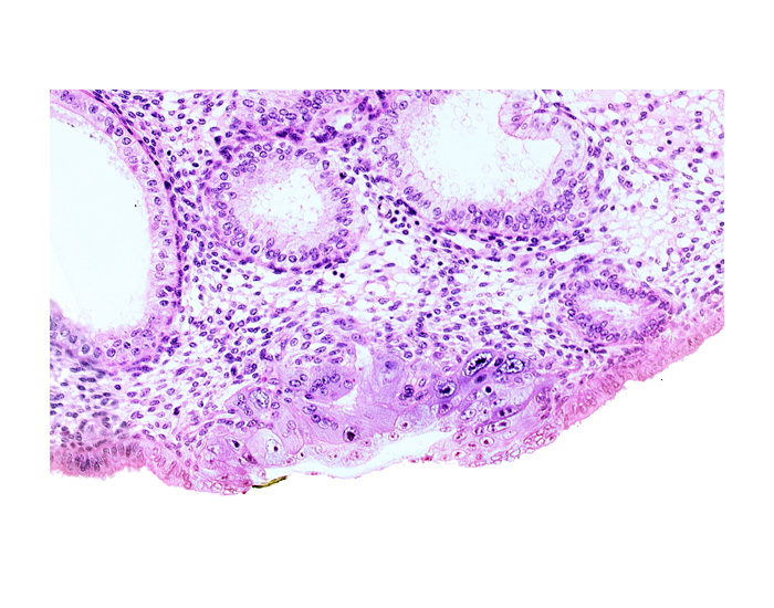 blastocystic cavity (blastocoele), cytotrophoblast, edematous endometrial stroma (decidua), endometrial epithelium, endometrial sinusoid, membranous trophoblast at abembryonic pole, solid syncytiotrophoblast, uterine cavity