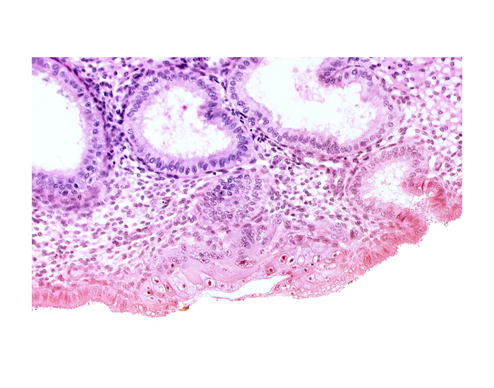 blastocystic cavity (blastocoele), cytotrophoblast, endometrial epithelium, endometrial gland, endometrial sinusoid, membranous trophoblast at abembryonic pole, mouth of endometrial gland, uterine cavity