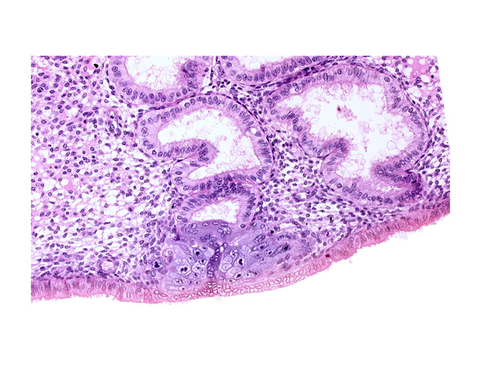 cytotrophoblast, edematous endometrial stroma (decidua), endometrial epithelium, endometrial sinusoid, lumen of endometrial gland, solid syncytiotrophoblast