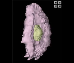 Trophoblast and Embryo