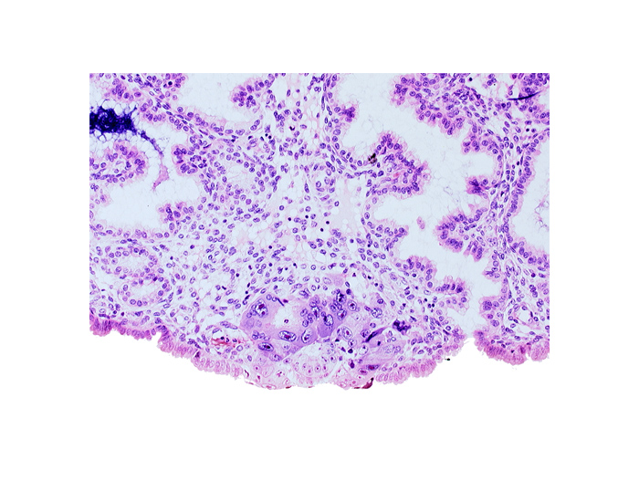 amniotic cavity, blastocystic cavity (blastocoele), epiblast, hypoblast, lumen of endometrial gland, membranous trophoblast at abembryonic pole, mouth of adjacent endometrial gland, solid syncytiotrophoblast