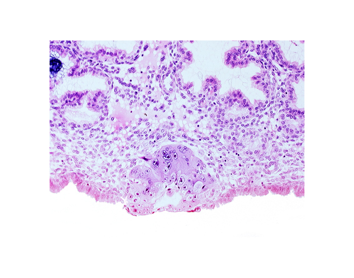 blastocystic cavity (blastocoele), cytotrophoblast, embryonic disc, membranous trophoblast at abembryonic pole, solid syncytiotrophoblast