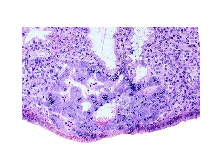 cytotrophoblast, disrupted endometrial gland cells, endometrial epithelium, lumen of endometrial gland, primary umbilical vesicle cavity, syncytiotrophoblast, uterine cavity