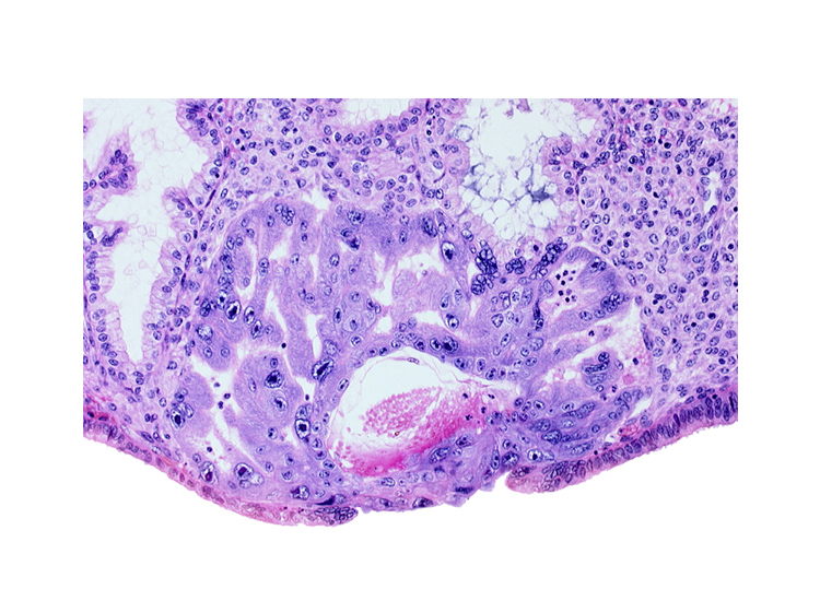 extra-embryonic mesoblast, intercommunicating lacunae, lumen of endometrial gland, maternal blood cells in primary umbilical vesicle cavity, primary umbilical vesicle cavity