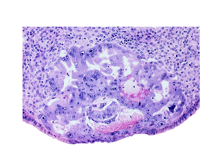 amnioblast(s), amniotic cavity, cytotrophoblast, degenerated endodermal epithelium, endometrial sinusoid, epiblast, hypoblast, intercommunicating trophoblastic lacunae, maternal blood cells in primary umbilical vesicle cavity, syncytiotrophoblast