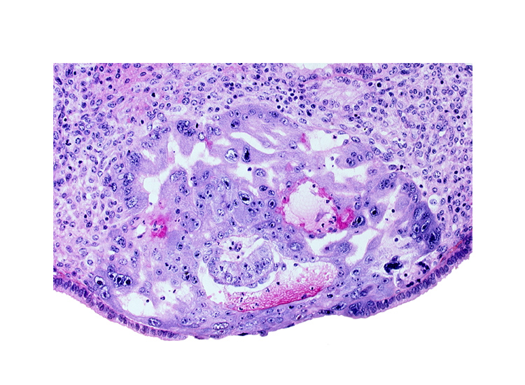 amnioblast(s), cytotrophoblast, edge of amniotic cavity, embryonic disc, endometrial epithelium, previllus clump of cytotrophoblast, syncytiotrophoblast, uterine cavity