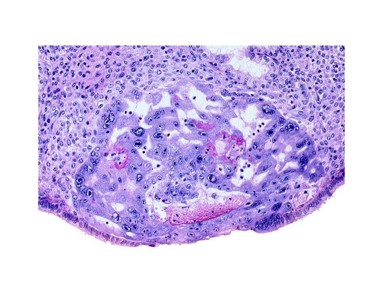 disrupted endometrial epithelium, intact endometrial epithelium, maternal blood cells in primary umbilical vesicle cavity