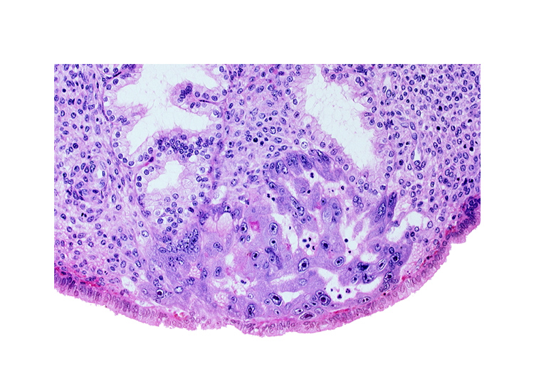 endometrial sinusoid, intact endometrial epithelium, lumen of endometrial gland, uterine cavity