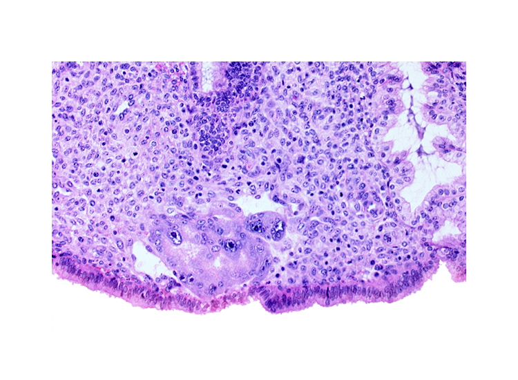 edge of trophoblast lacuna(e), endometrial sinusoid, syncytiotrophoblast