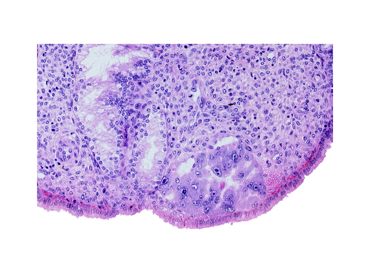 intact endometrial epithelium, lacunae, syncytiotrophoblast