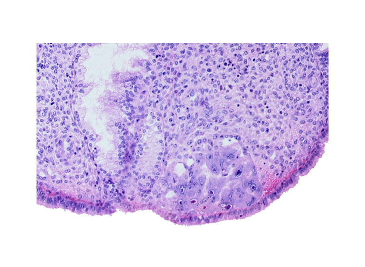 intact endometrial epithelium, lumen of endometrial gland, syncytiotrophoblast