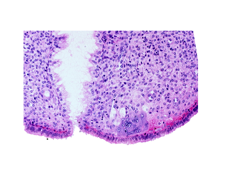 syncytiotrophoblast