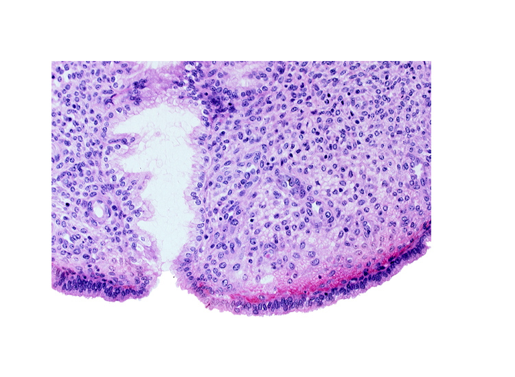 endometrial sinusoid, intact endometrial epithelium, uterine cavity