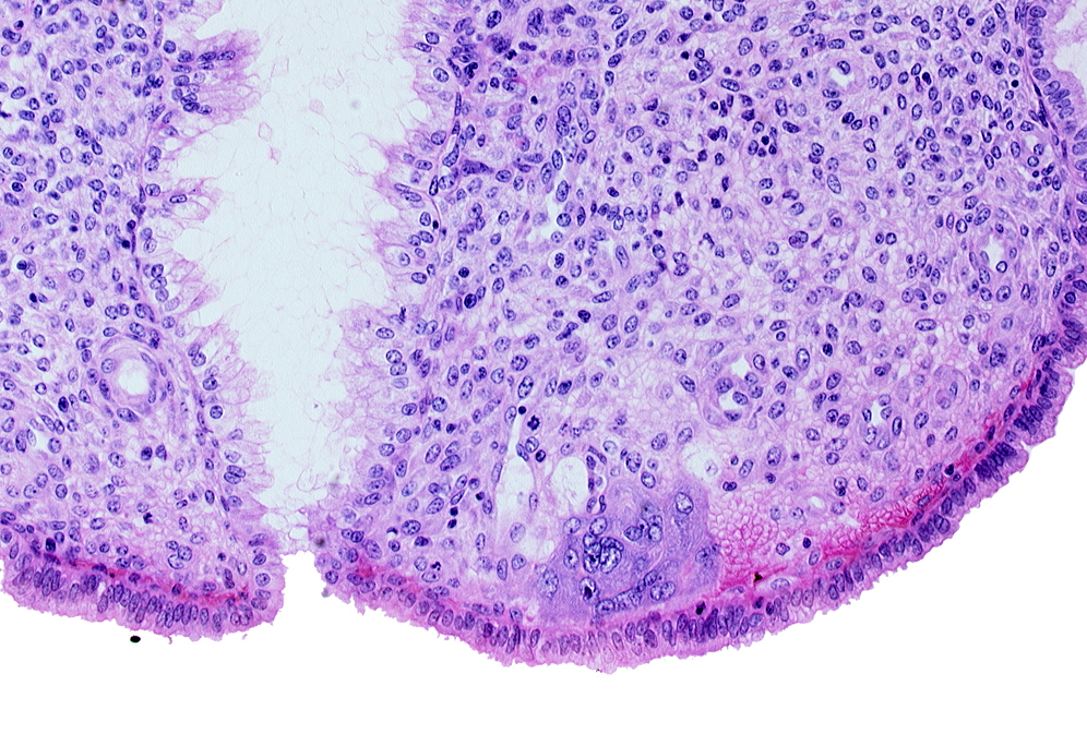 endometrial stroma (decidua), intact endometrial epithelium, lumen of endometrial gland, syncytiotrophoblast