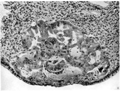 High-power view of embryo