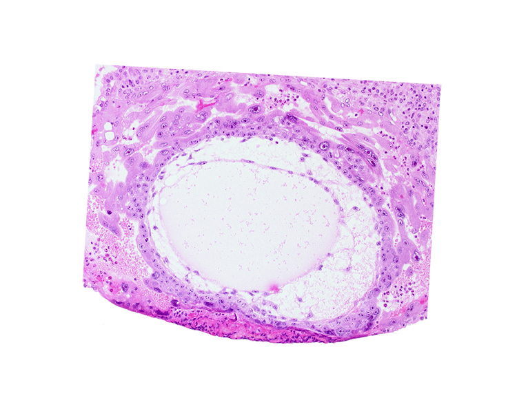 chorionic cavity, definitive exocoelomic (Heuser's) membrane, primary umbilical vesicle cavity, syncytiotrophoblast, uterine cavity