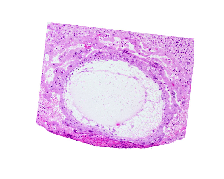 chorionic cavity, definitive exocoelomic (Heuser's) membrane, primary umbilical vesicle cavity, syncytiotrophoblast, uterine cavity