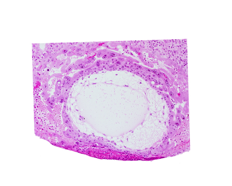 chorionic cavity, definitive exocoelomic (Heuser's) membrane, extra-embryonic mesoblast, primary umbilical vesicle cavity