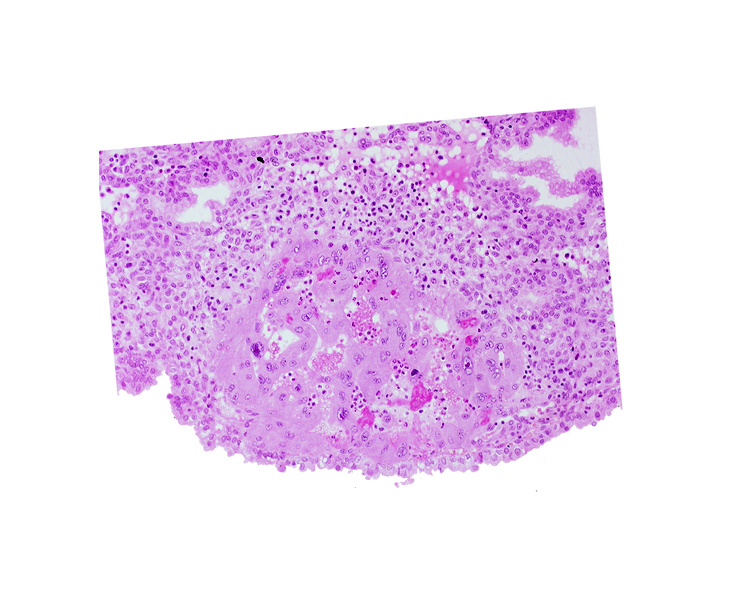 edematous endometrial stroma (decidua), endometrial epithelium, maternal blood cells in trophoblast lacuna, syncytiotrophoblast, syncytiotrophoblast / decidua interface, uterine cavity