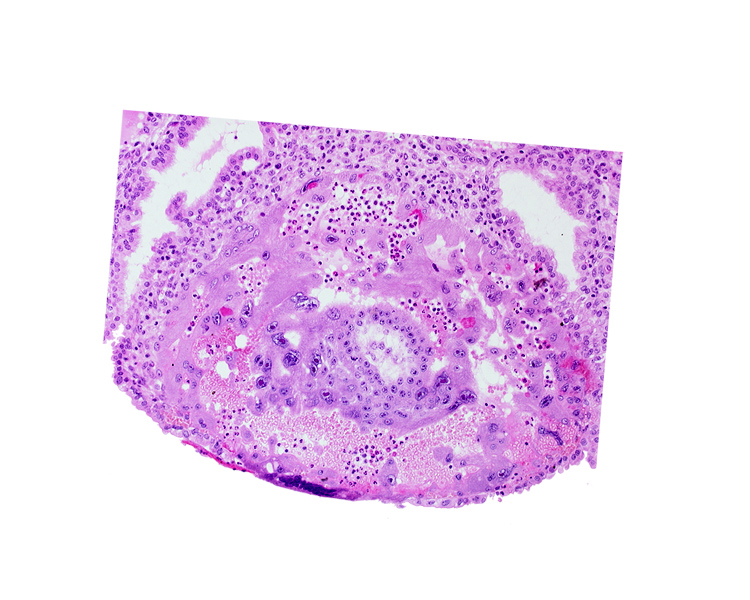 chorionic cavity, disrupted endometrial epithelium, maternal blood cells in trophoblast lacuna, syncytiotrophoblast, uterine cavity