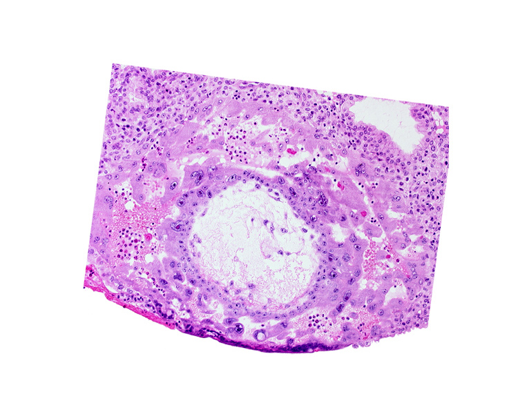 chorion, cytotrophoblast, disrupted endometrial epithelium, extra-embryonic reticulum, lacunar vascular circle