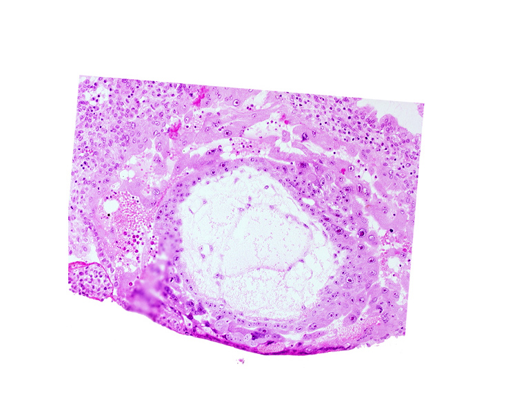 chorionic cavity, extra-embryonic reticulum, lacunar vascular circle