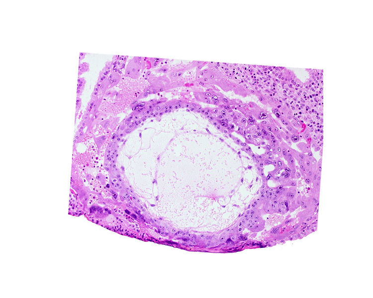 chorionic cavity, exocoelomic (Heuser's) membrane, extra-embryonic mesoblast, uterine cavity