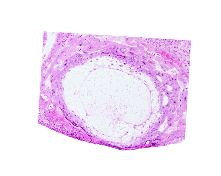 condensed extra-embryonic mesoblast, cytotrophoblast, exocoelomic (Heuser's) membrane, fibrous coagulum, lacunar vascular circle, previllus mesoblast clump, trophoblast lacunae