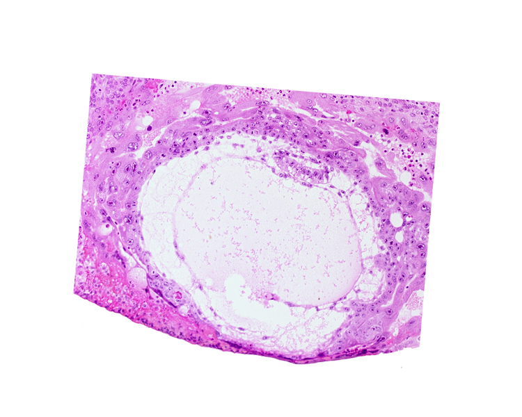 amnioblast(s), amniotic cavity, chorionic cavity, epiblast, extra-embryonic endoblast, extra-embryonic mesoblast, hypoblast, previllus mesoblast clump, primary umbilical vesicle cavity