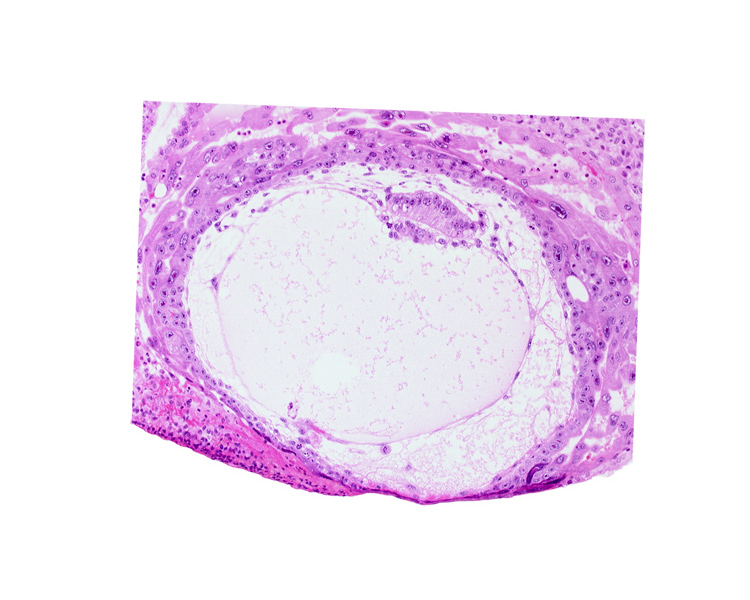 chorionic cavity, extra-embryonic mesoblast, lacunar vascular circle, primary umbilical vesicle cavity, uterine cavity