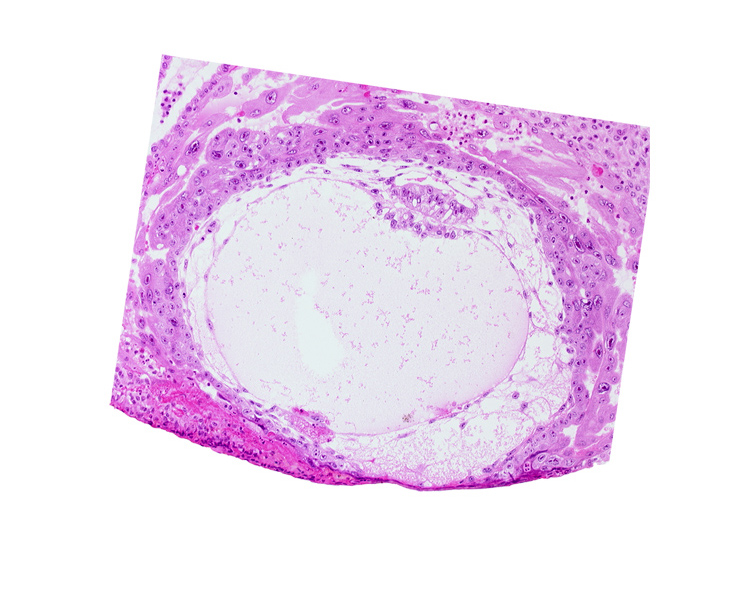 chorionic cavity, epiblast vacuole, fibrous coagulum, primary umbilical vesicle cavity, uterine cavity