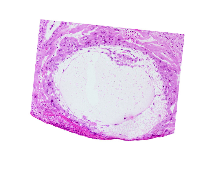 exocoelomic (Heuser's) membrane, extra-embryonic mesoblast, fibrous coagulum, primary umbilical vesicle cavity, uterine cavity